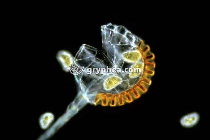 Polypode - Sporange ouvert et spores x40 - gryphea.com